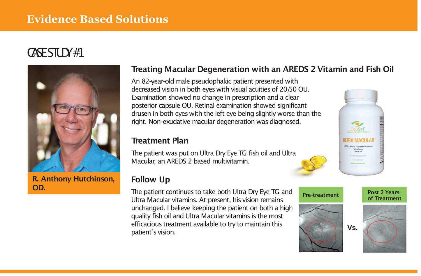 Ultra Macular - AREDS2 (12)